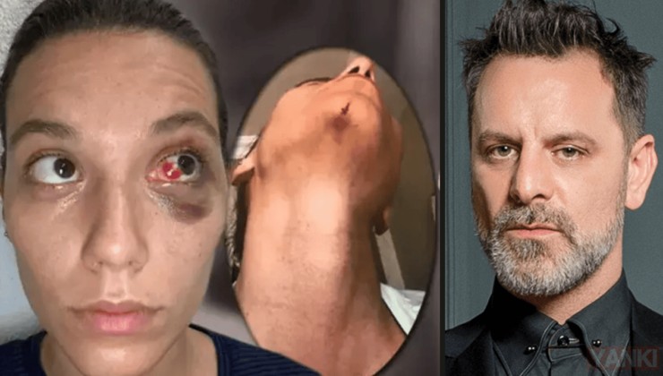 Ozan Güven’e 11 Yıl Hapis İstemi! Abajur ‘Silah’ Sayıldı