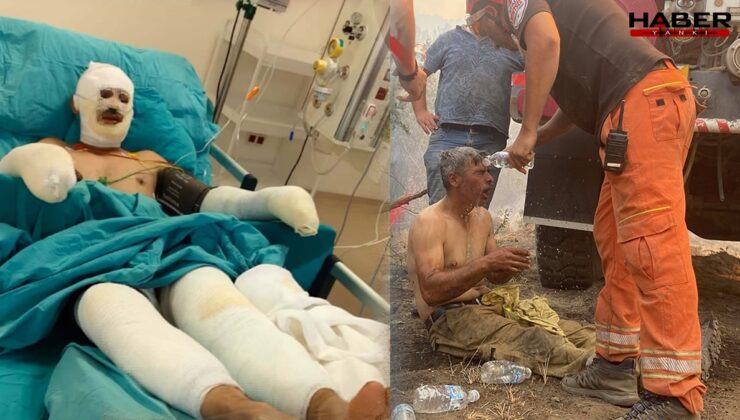 Orman yangınında yaralanan orman işçisinin son hali ortaya çıktı