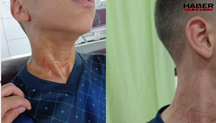 Konya’daki ortaokulda öğretmenden öğrenciye darp iddiası: "Seni öldürürüm"