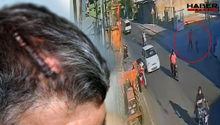 Miras için beyzbol sopasıyla dövüldü: Mahkemenin kararı ile  ikinci şoku yaşadı