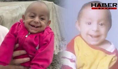 Sosyal medyada 'Gülen Bebek' olarak tanınan Ökkeş bebek yaşamını yitirdi