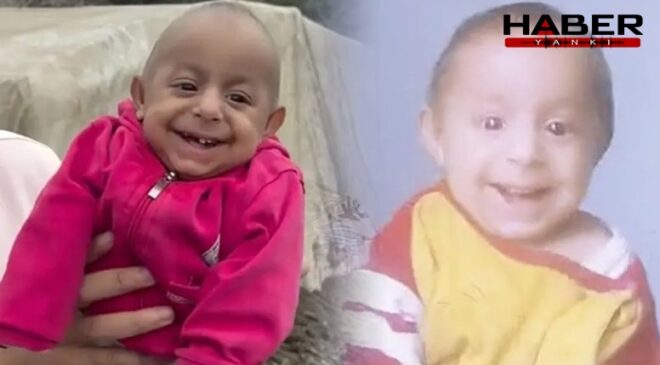 Sosyal medyada 'Gülen Bebek' olarak tanınan Ökkeş bebek yaşamını yitirdi