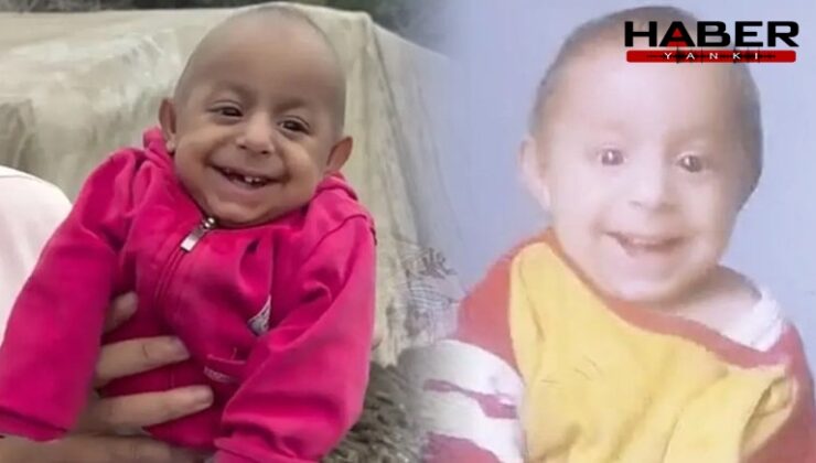 Sosyal medyada 'Gülen Bebek' olarak tanınan Ökkeş bebek yaşamını yitirdi