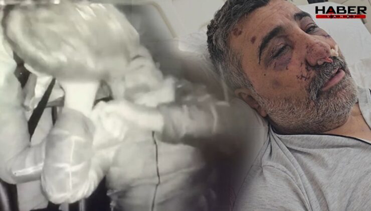 Taksiciyi öldüresiye dövdü: İngiliz boksörün mahkemedeki ifadesi ortaya çıktı