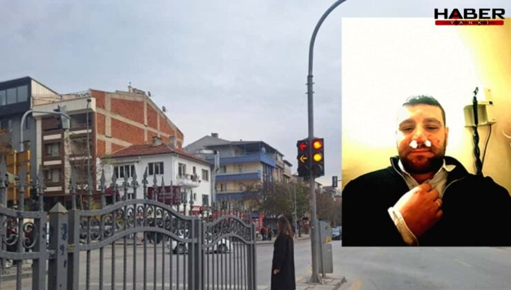 Trafik tartışmasında avukatın burnunu kırdılar