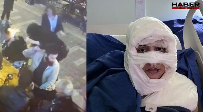 Bir kadının üzerine yanıcı madde döktü, ateşe verdi! Cani sanığa 4 yıl hapis istendi