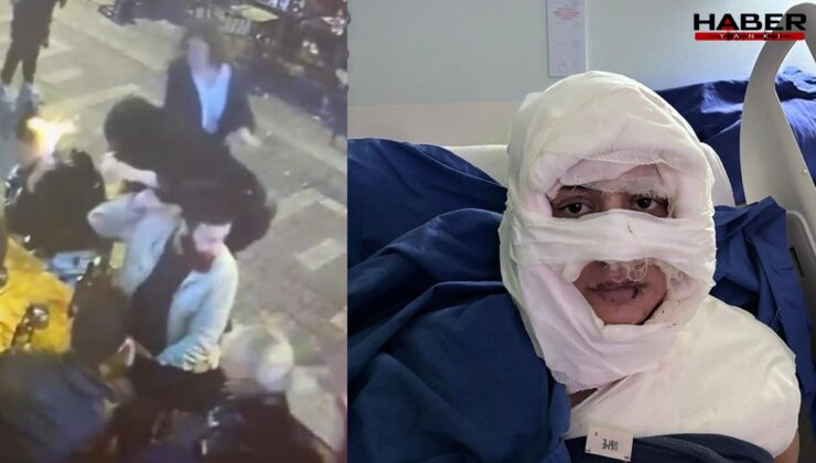 Bir kadının üzerine yanıcı madde döktü, ateşe verdi! Cani sanığa 4 yıl hapis istendi